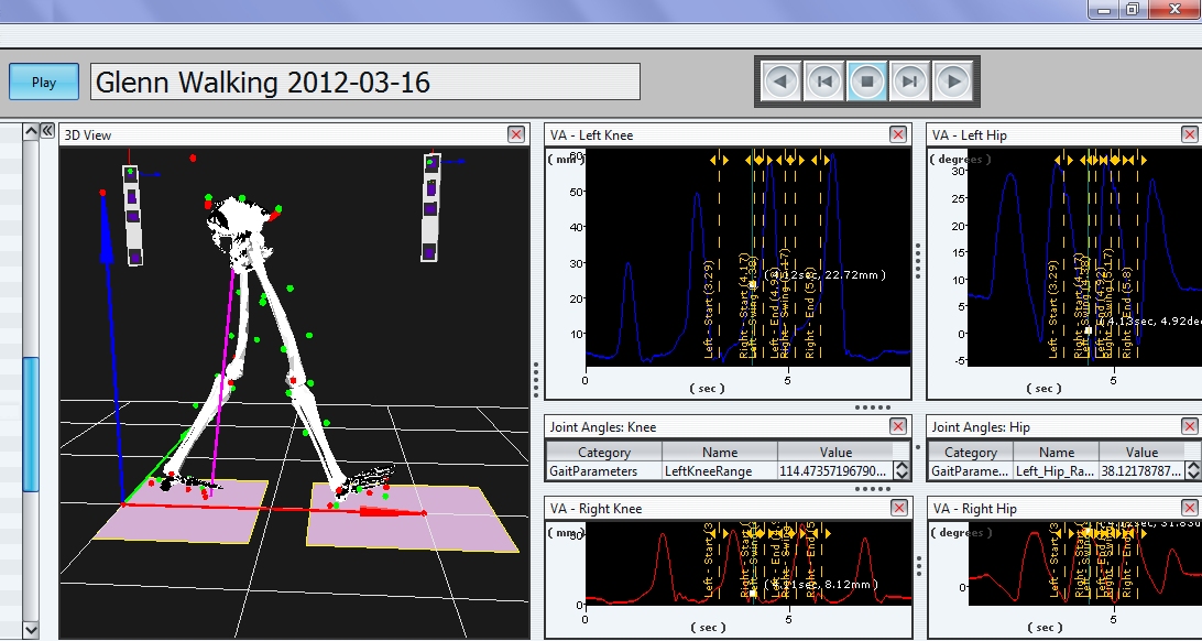 Force Platforms & Walkways (Other Measurement Components)